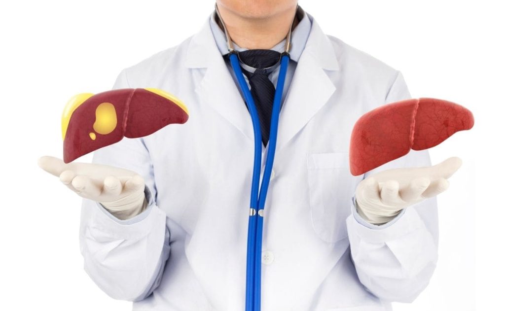 How a personalized medicine influences patients with simply non-alcoholic fatty liver scam