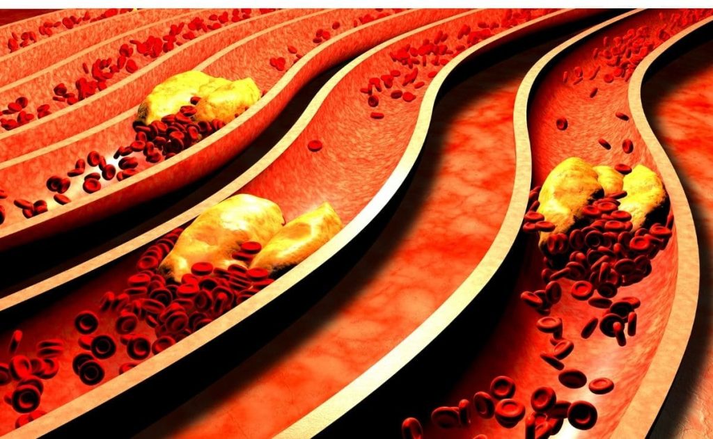 Answer to all the 5 most frequent doubts about a cholesterol