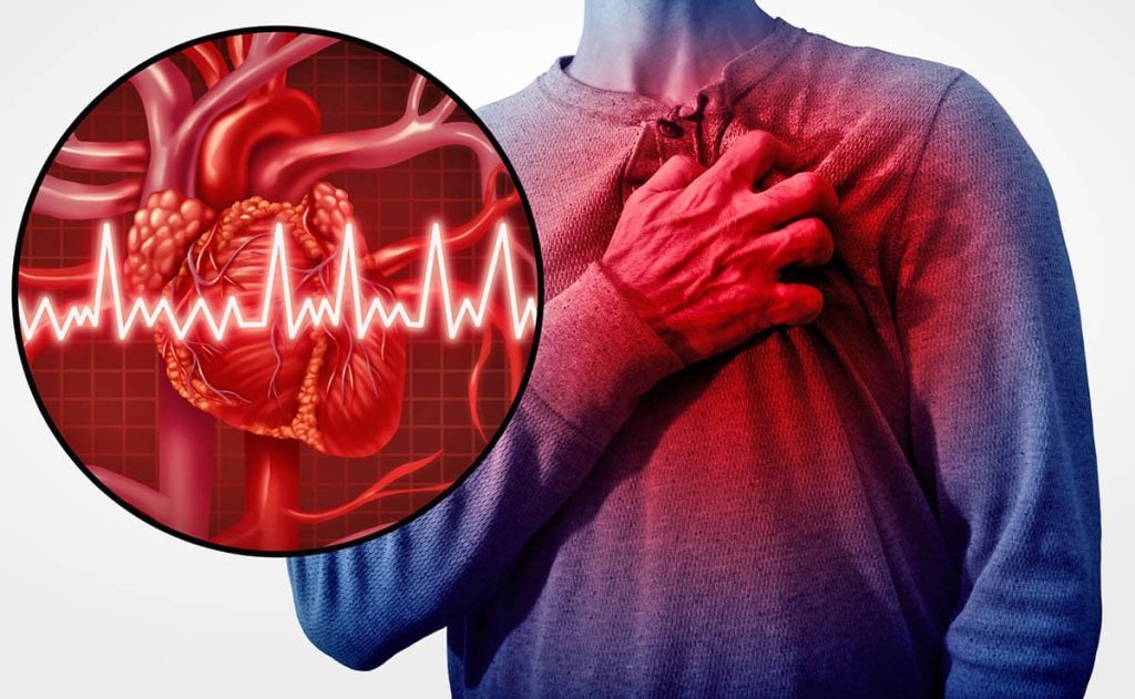 A fault on symptoms, the problem to detect high cholesterol