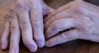 Why treat rheumatoid arthritis early?